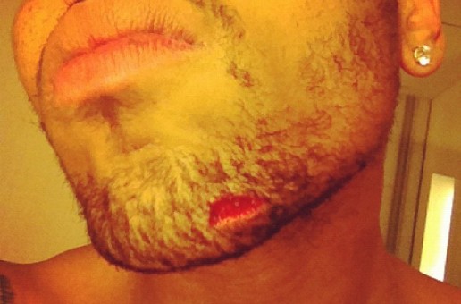 Drake Throws A Bottle At Chris Brown Last Night In The Club (Fight Details and CB Face Inside)