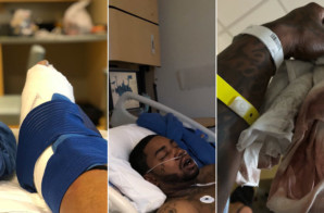 Lil Scrappy Seriously Injured In Car Crash!