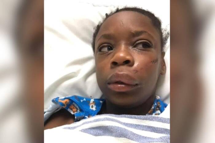 Kansas-City-girl-reportedly-beat-unconscious-in-alleged-racist-attack KANSAS CITY GIRL REPORTEDLY BEAT UNCONSCIOUS IN ALLEGED RACIST ATTACK  