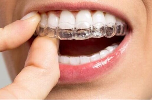 Tips To Take Care Of Your Invisalign